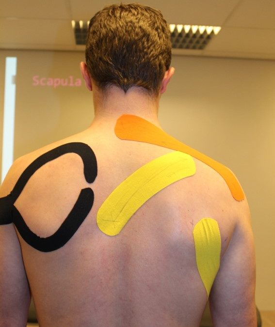 Taping Elastique et Raisonnement Clinique